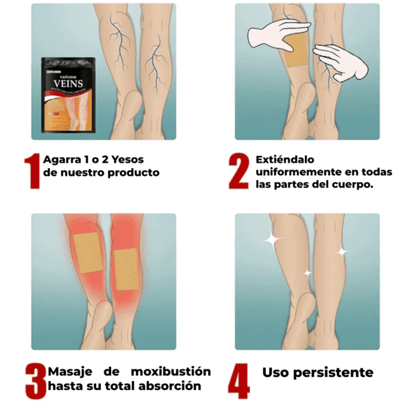 Parches De Tratamiento De Varices SUPER OFERTA 2 x 169Q + ENVÍO GRATIS