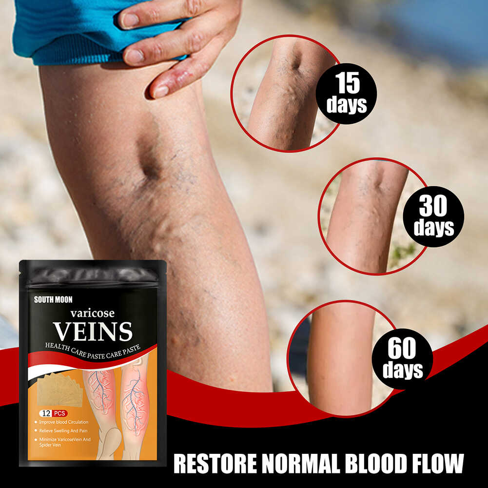 Parches De Tratamiento De Varices SUPER OFERTA 2 x 169Q + ENVÍO GRATIS