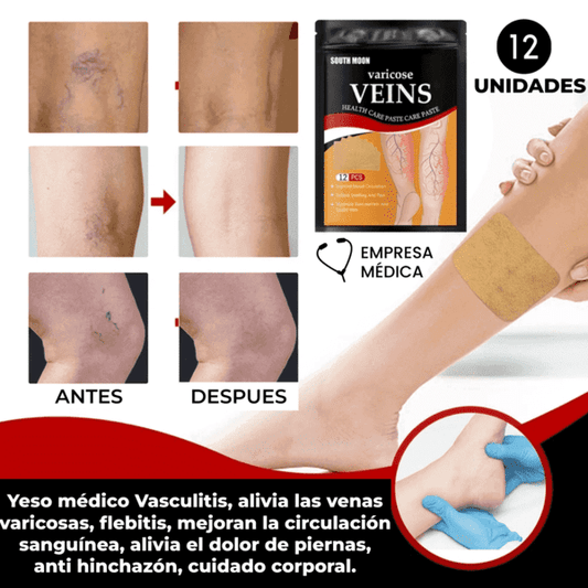 Parches De Tratamiento De Varices SUPER OFERTA  2 x 169Q + ENVÍO GRATIS